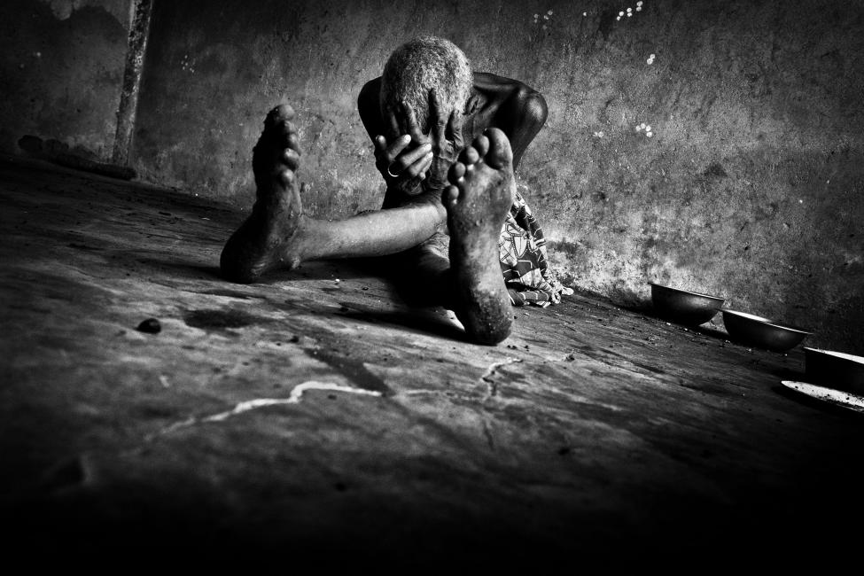Fotografía de Antonio Aragón Renuncio para Nthephoto. Les Sorcières… las brujas… las devoradoras de almas… …en Burkina Faso. En medio de la sabana profunda. Lejos de todo. Cerca de nada…  Todavía hoy, en la cultura tribal de los Mossi, muchas mujeres son acusadas de “brujas” por sus vecinos, sencillamente por creer que son las culpables de alguna desgracia que acontece en la aldea. Sin sentido. Culpadas por desconocimiento, por tener alguna discapacidad, por superstición, o simple venganza… 	Las llegan a buscar a sus casas… con sed de sangre… con ansias de matarlas… en medio de la sabana. Muchas mueren a manos de sus familias, otras se suicidan antes de ser protagonistas de una orgia de maldad, sufrimiento y sangre. Las más afortunadas consiguen escapar de la “justicia” social y de su nada prometedor futuro. A hurtadillas… furtivas… desahuciadas, destruidas, malditas… solas.  	Y hasta acá llegan, al poblado de las “brujas”. Hacinadas. Durmiendo y comiendo -gracias a la caridad de algún corazón bondadoso- en el suelo. Con sus pocas pertenencias amontonadas a sus pies. Enfermas, ancianas, olvidadas, analfabetas, exiliadas, malditas… solas.  Otro infierno para mujeres. Siempre mujeres, siempre malditas…   …siempre solas.